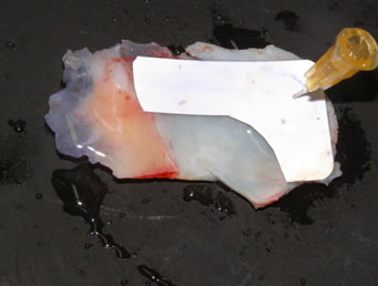 Utilizzo di un “template” (in pratica una dima) in plastica per premisurare con esattezza l'innesto di cartilagine da prelevare dal setto
